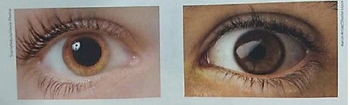Dilatação e a contração da pupila