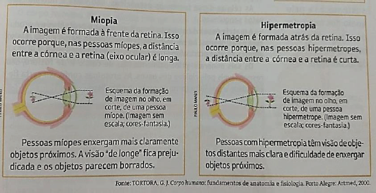 Disfunções oculares